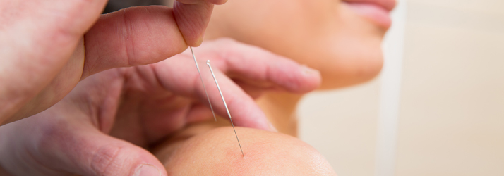 Chiropractic Mandan ND Acupuncture